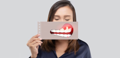 Bleeding Gums Battle: Urgency in Emergency Dentistry